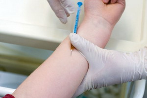 Прививка от туберкулеза детям: вакцинация и проба Манту