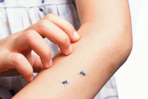 Профилактика и лечение укусов насекомых у детей